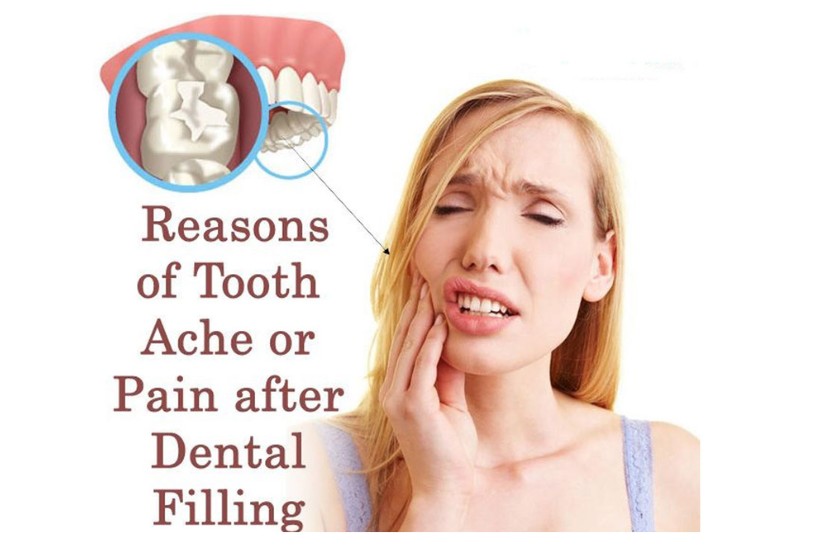 Pain After Dental Fillings - Modern Dentistry of Jupiter