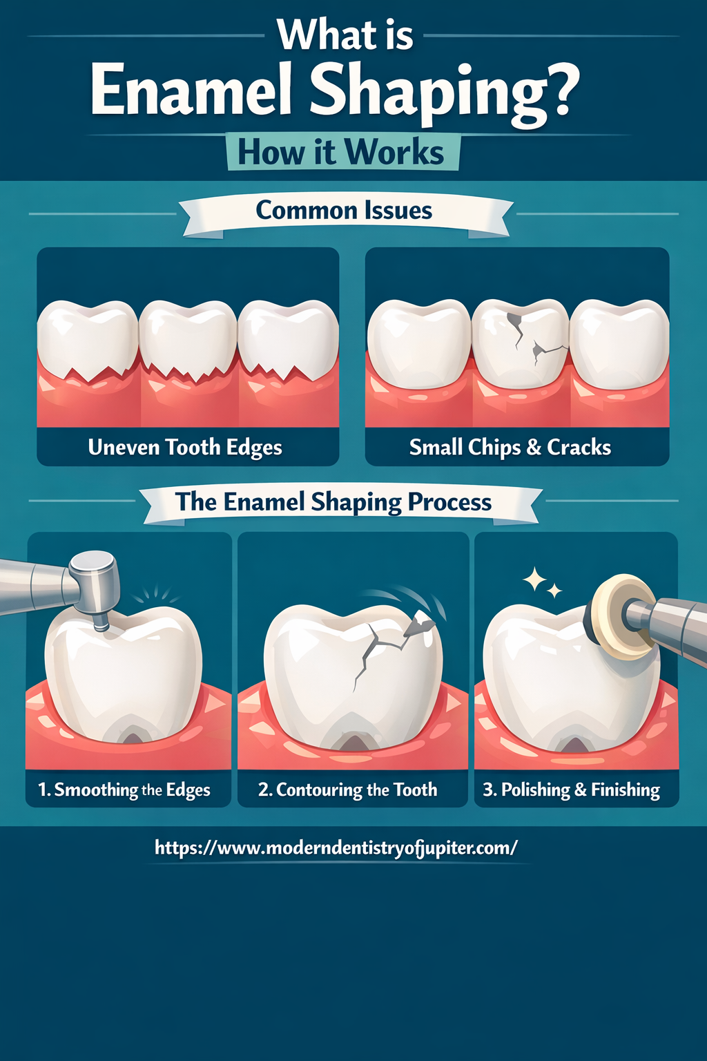 Enamel Creases 30-Minute Enamel Shaping for a Smoother Smile
