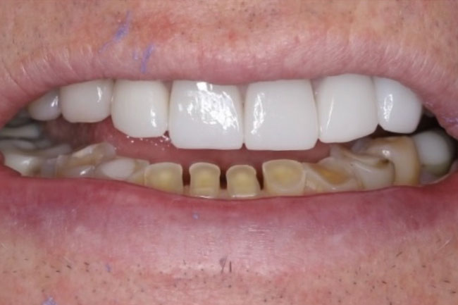 Before full makeover