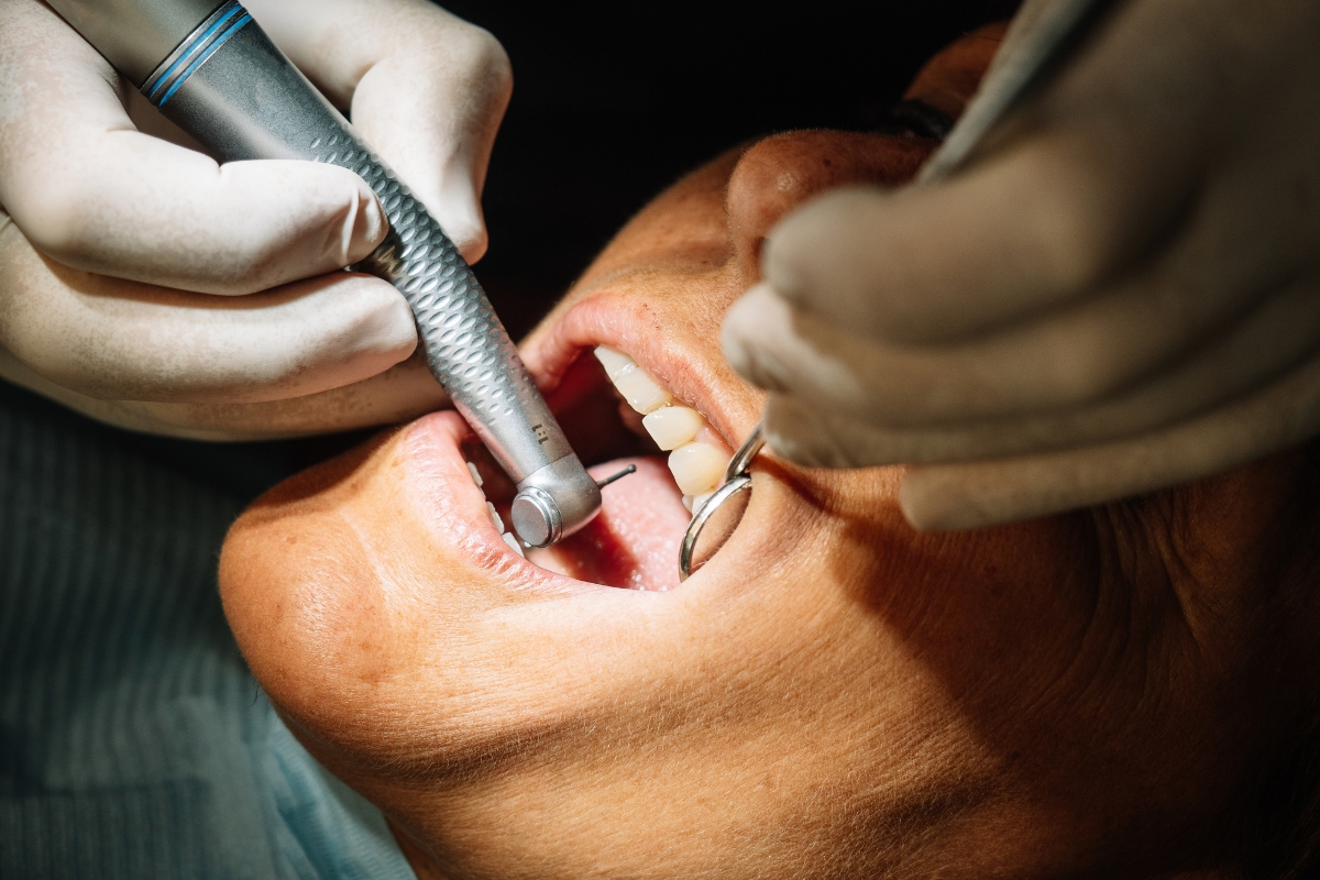 dental-implants-in-Jupiter