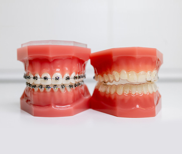 Invisalign Jupiter FL